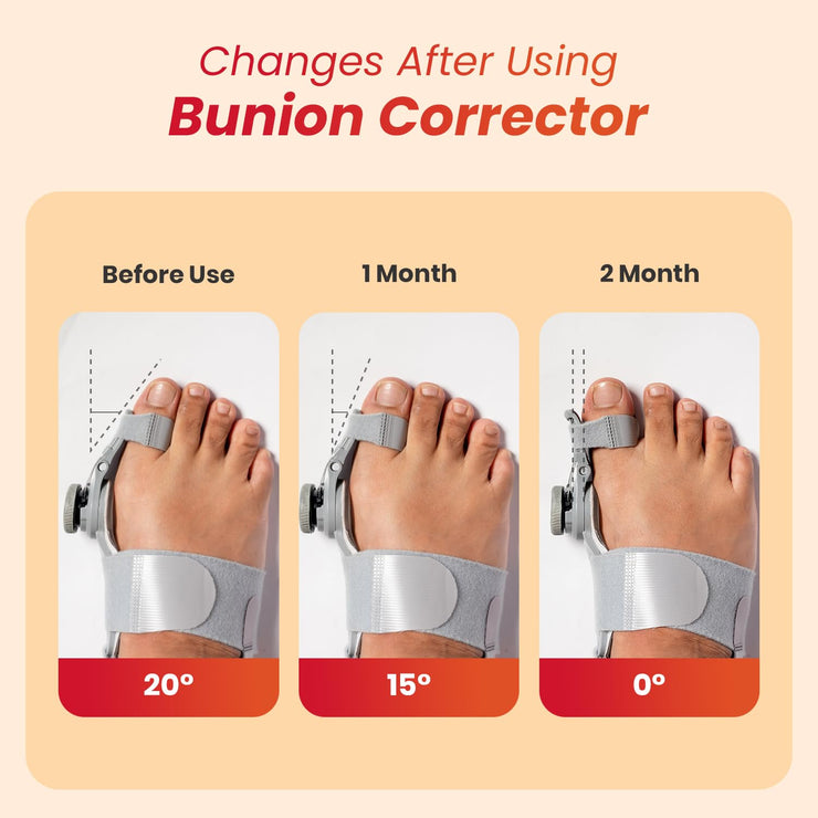 Adjustable Toe Straightener for Men & Women